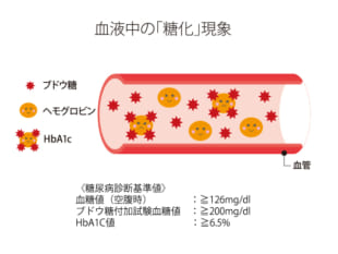 血液中の糖化の具合は健康診断でわかる!?